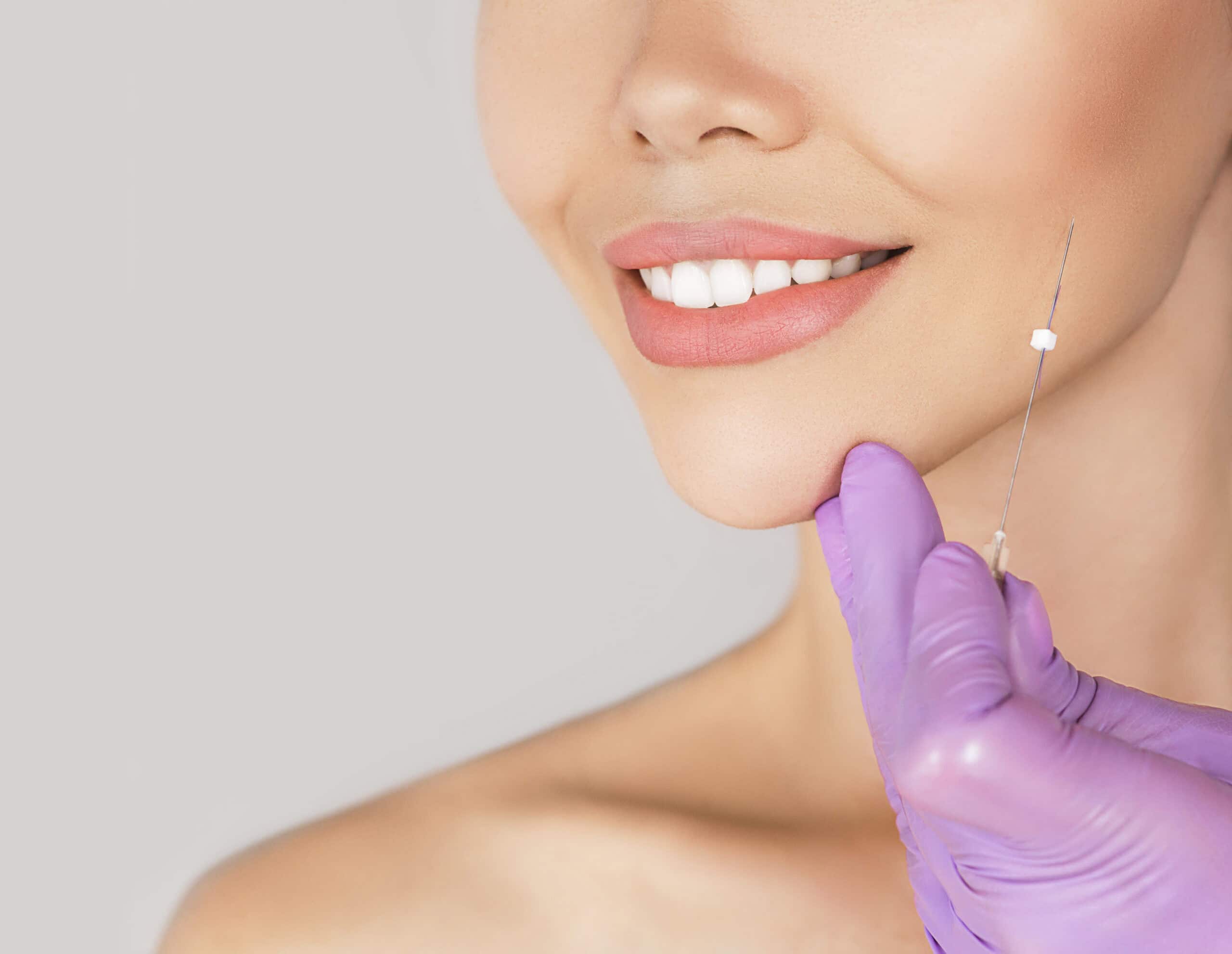 PDO Thread Lift to lift, tighten and contour skin and jawline