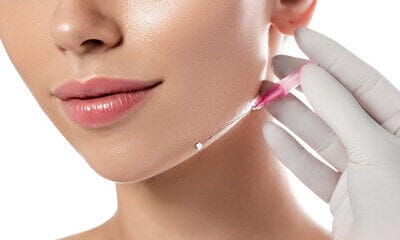 9 Fun Facts About Thread Lifts