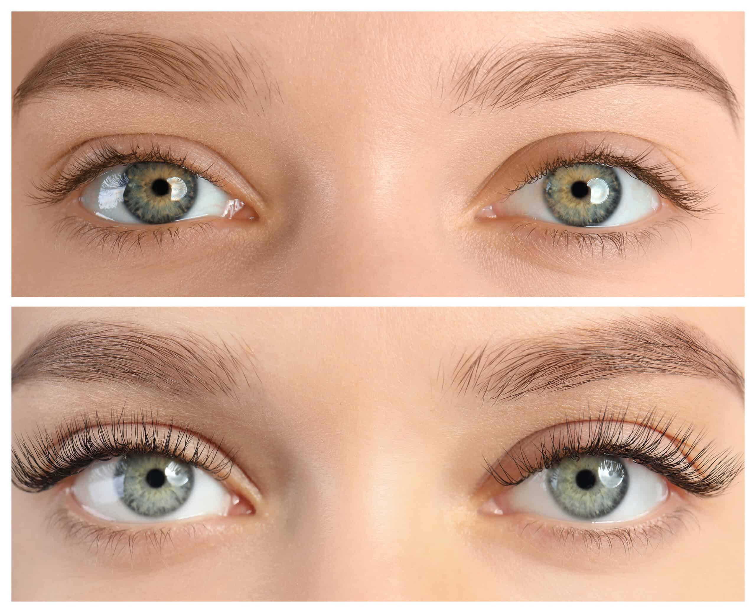 Latisse Eyelash Serum