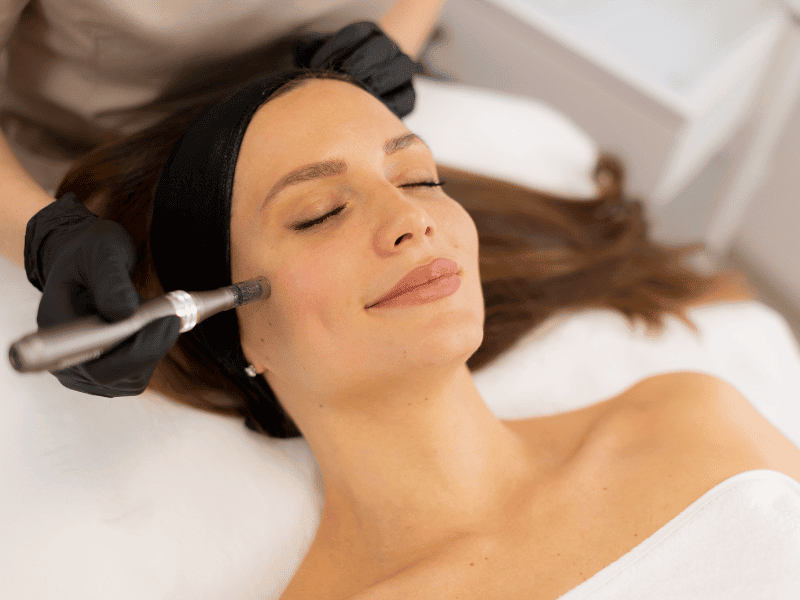 State-of-the-Art Technology for Microneedling in Etobicoke State-of-the-Art Technology for Microneedling in Etobicoke