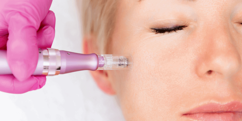 Is Microneedling Really Worth It? Microneedling Benefits & Uses